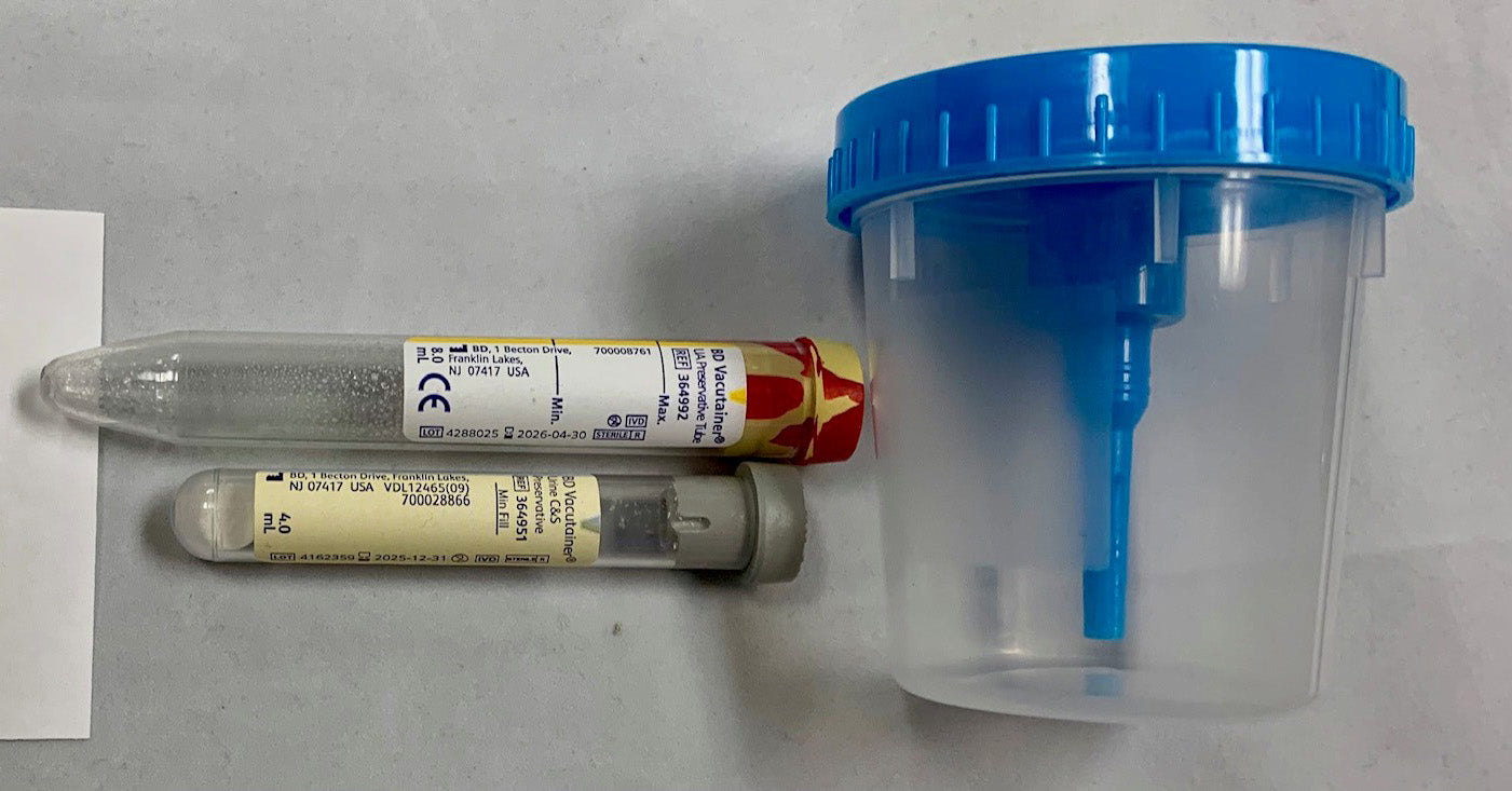 LSL URINE COLLECTION KIT WITH CUP AND INTEGRATED TRANSFER DEVICE, URINALYSIS TUBE WITH RED/YELLOW CAP, URINE CULTURE AND SENSITIVITY TUBE WITH GREY CAP AND BAG, 50 EA/CA